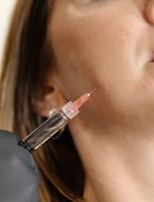 Anti-wrinkle injections