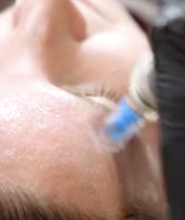Skin rejuvenation facial